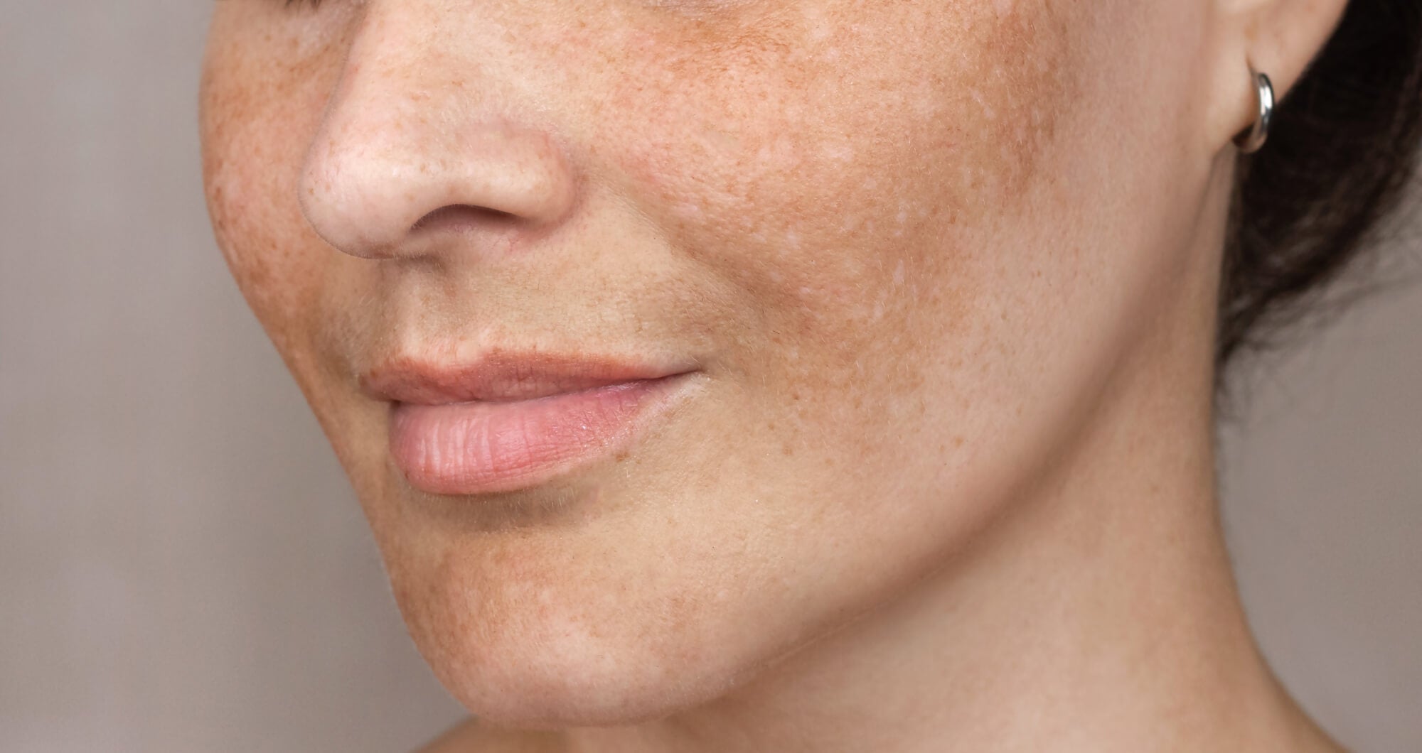 THE SUNDAY EDIT: How to deal with uneven skin tone and sun spots