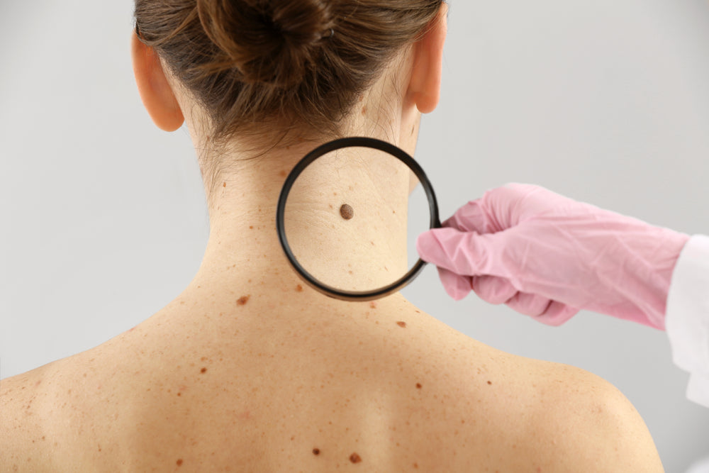 What Does Skin Cancer Look Like?