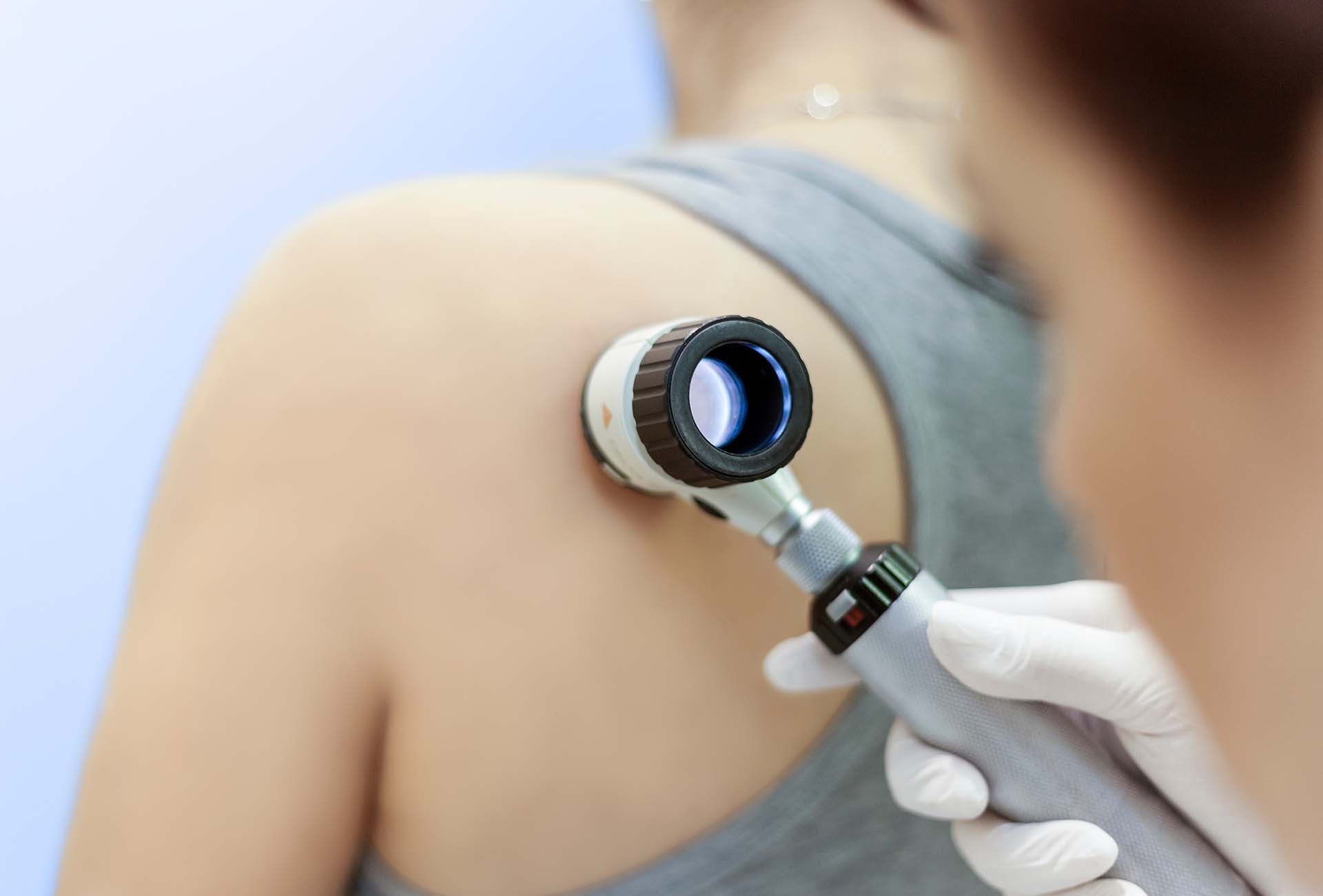 consultant dermatologist in London