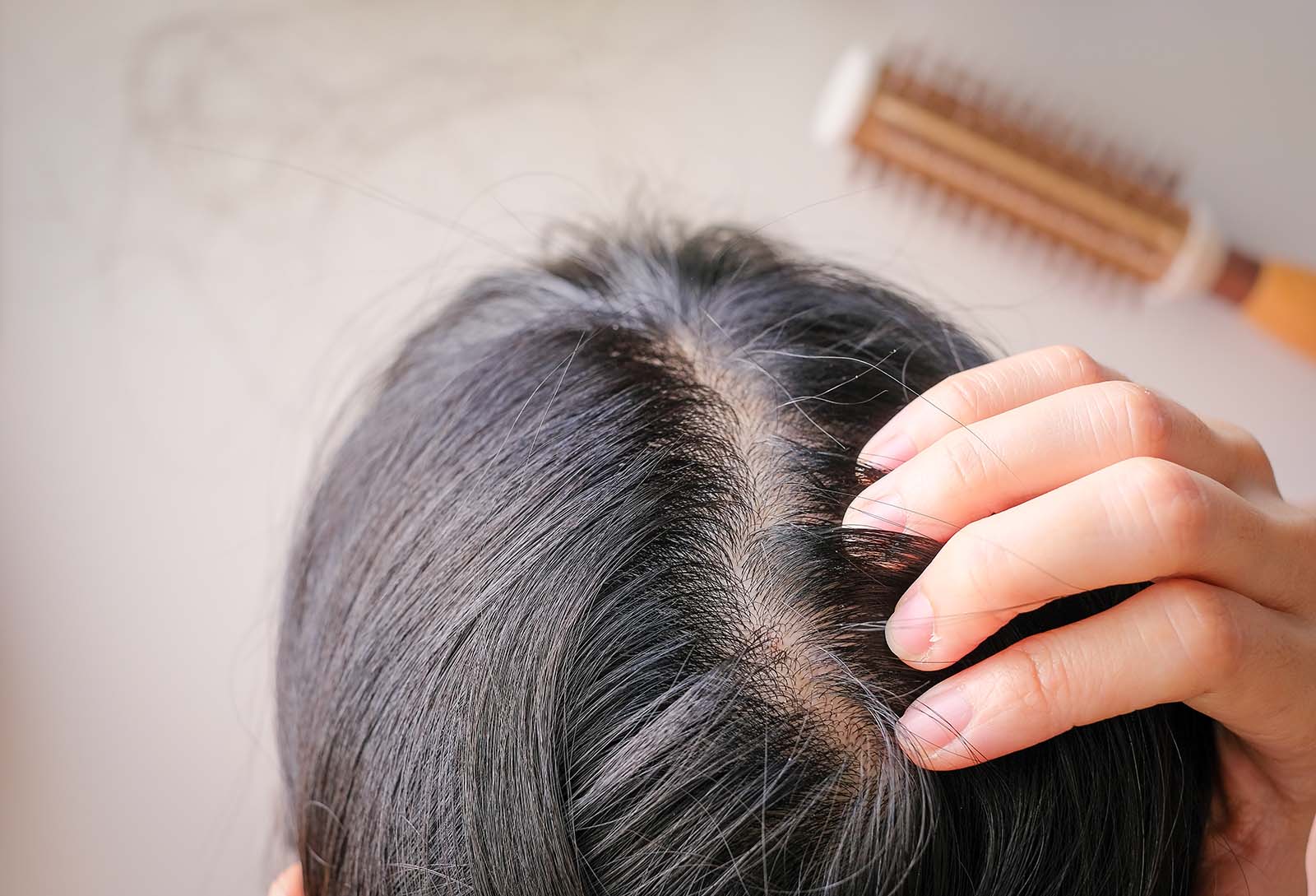 hair thinning loss treatment alopecia dermatologist