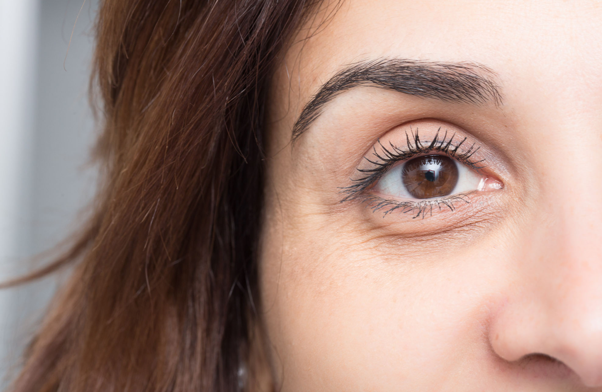 How can I get rid of Dark Circles under the eyes?