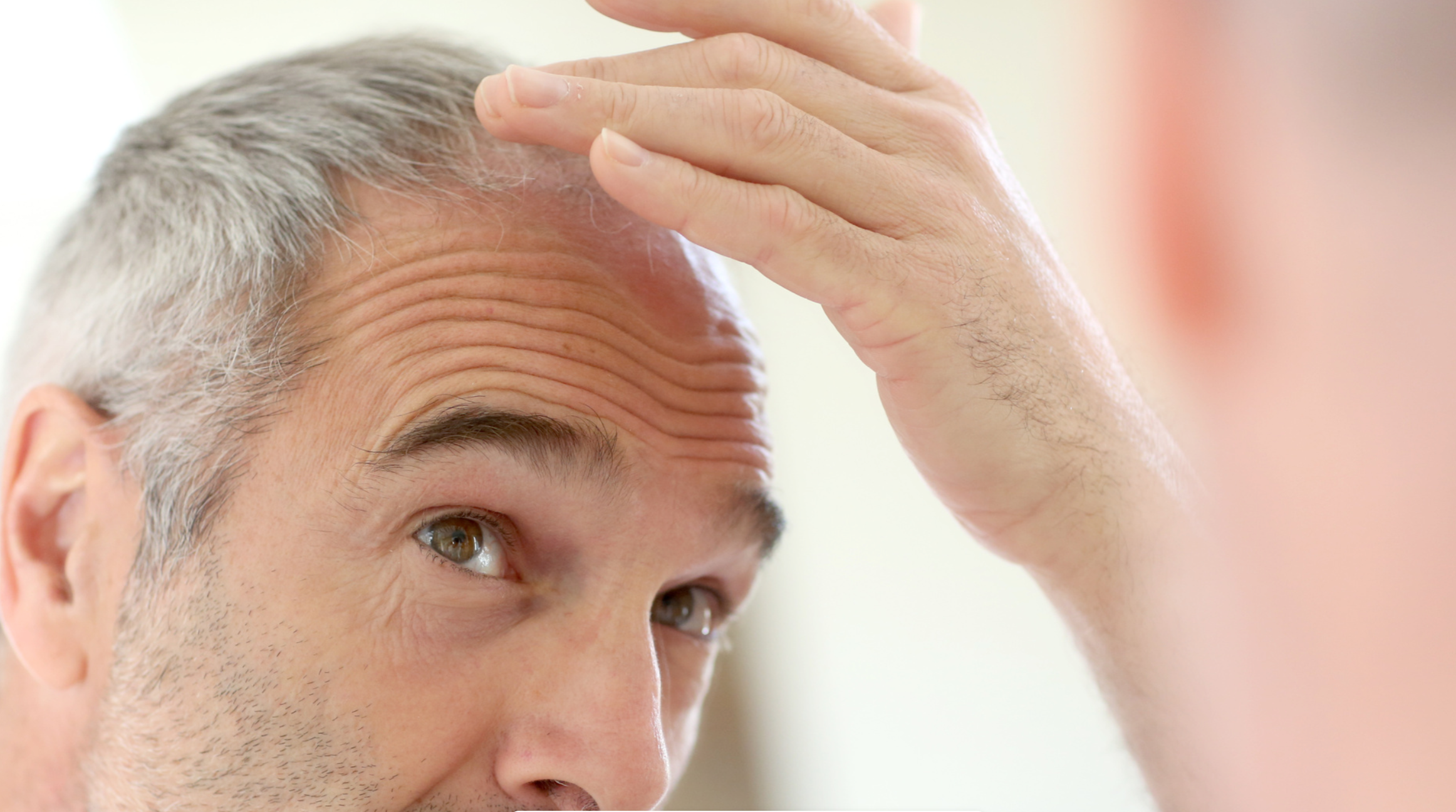 Male Hair Loss and Thinning