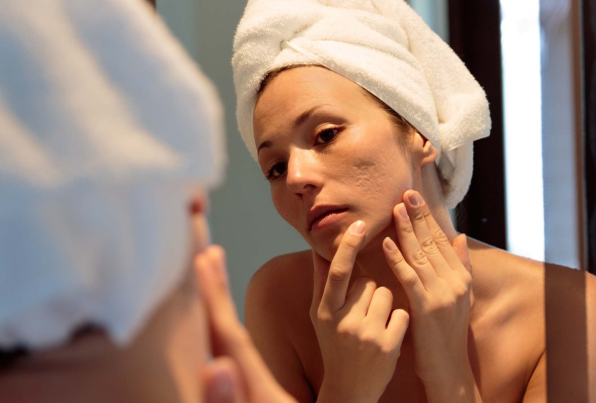acne scarring dermatologist in London