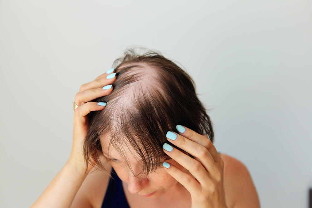 Five Causes Of Hair Loss In Women And The Treatments That Can Help